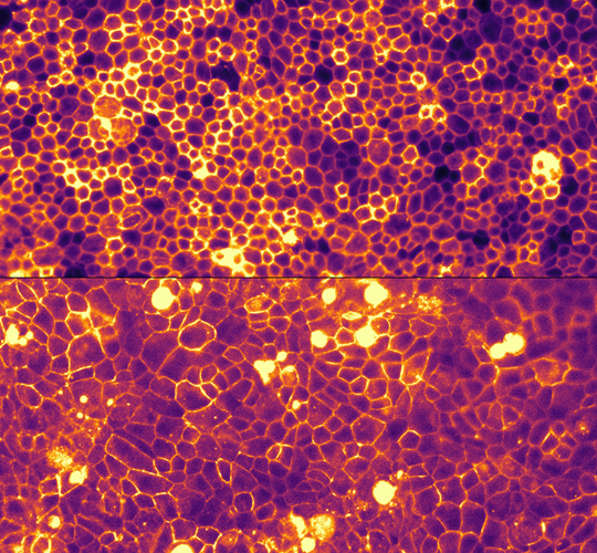 Stem cell–derived RPE model showing young tissue and reduced cell density mimicking ageing.